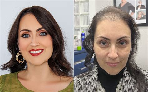 cnc hair system|Women's CRLAB Hair Loss Solutions .